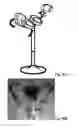 Fig. 47 - Mobility assistance device