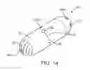 Fig. 02 - Methods for delivering entanercept preparations into a lumen of the intestinal tract using a swallowable drug delivery device