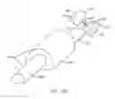 Fig. 22 - Methods for delivering entanercept preparations into a lumen of the intestinal tract using a swallowable drug delivery device