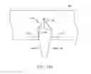Fig. 35 - Methods for delivering entanercept preparations into a lumen of the intestinal tract using a swallowable drug delivery device