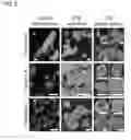 Fig. 03 - NANOBIOCOMPOSITE COMPOSITIONS AND METHODS
