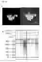 Fig. 14 - NANOBIOCOMPOSITE COMPOSITIONS AND METHODS