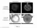 Fig. 07 - MECHANO-SENSITIVE MICROCAPSULES FOR DRUG DELIVERY