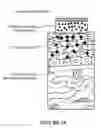 Fig. 28 - Two-stage microparticle-based therapeutic delivery system and method