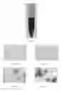 Fig. 08 - Treating infection by a platelet-targeting microbe using nanoparticles