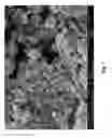 Fig. 02 - Taxane particles and their use