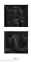 Fig. 03 - Crystal forms of tetrahydro-N,N-dimethyl-2,2-diphenyl-3-furanmethanamine hydrochloride, processes of making such forms, and their pharmaceutical compositions