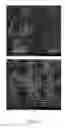 Fig. 16 - Crystal forms of tetrahydro-N,N-dimethyl-2,2-diphenyl-3-furanmethanamine hydrochloride, processes of making such forms, and their pharmaceutical compositions