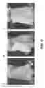 Fig. 43 - Small molecule analogs of the nemo binding peptide