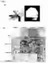 Fig. 02 - Compositions and methods comprising growth factors, chondroitin and glucosamine for degenerative disc regeneration