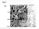 Fig. 10 - Compositions and methods comprising growth factors, chondroitin and glucosamine for degenerative disc regeneration