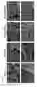 Fig. 05 - Injectable hydrogels that promote mineralization and afford sustained release of bioactive ions