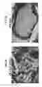 Fig. 06 - OXYGENATED DEMINERALIZED BONE MATRIX FOR USE IN BONE GROWTH