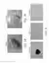 Fig. 04 - Optimized methods for generation of cardiac stem cells from cardiac tissue and their use in cardiac therapy