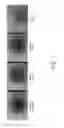 Fig. 08 - Optimized methods for generation of cardiac stem cells from cardiac tissue and their use in cardiac therapy