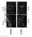 Fig. 12 - Conditioning protocols and use of same for tissue regeneration