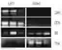 Fig. 01 - Methods of delivery of transgenes for treating brain diseases