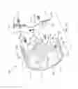 Fig. 49 - Sterilization container capable of providing an indication regarding whether or not surgical instruments sterilized in the container were properly sterilized