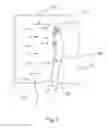 Fig. 03 - METHOD FOR APPLYING CHARGED PARTICLES TO AN IMPLANT