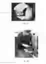 Fig. 02 - Viable disc regenerative composition and method of manufacture and use
