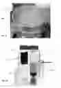 Fig. 07 - Viable disc regenerative composition and method of manufacture and use
