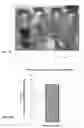 Fig. 08 - Viable disc regenerative composition and method of manufacture and use