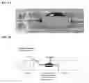 Fig. 02 - Methods And Compositions For The Treatment Of Open And Closed Wound Spinal Cord Injuries