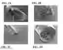 Fig. 04 - Methods And Compositions For The Treatment Of Open And Closed Wound Spinal Cord Injuries