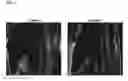 Fig. 05 - Methods And Compositions For The Treatment Of Open And Closed Wound Spinal Cord Injuries