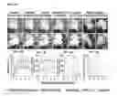 Fig. 09 - Methods And Compositions For The Treatment Of Open And Closed Wound Spinal Cord Injuries