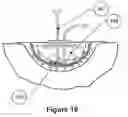 Fig. 22 - Dressing and apparatus for cleansing the wounds