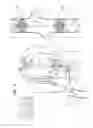 Fig. 07 - Blood pump