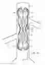 Fig. 10 - Blood pump
