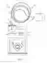 Fig. 02 - Medication fluid infusion set component with integrated physiological analyte sensor, and corresponding fluid infusion device