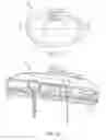 Fig. 10 - Medication fluid infusion set component with integrated physiological analyte sensor, and corresponding fluid infusion device