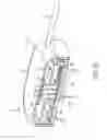 Fig. 15 - Medication fluid infusion set component with integrated physiological analyte sensor, and corresponding fluid infusion device