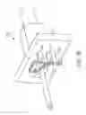 Fig. 23 - Medication fluid infusion set component with integrated physiological analyte sensor, and corresponding fluid infusion device