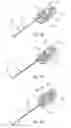 Fig. 22 - Auto-injector