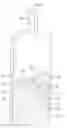 Fig. 01 - Negative pressure syringe for drip prevention