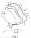 Fig. 03 - Passive nose bridge pressure distributing insert