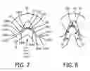Fig. 07 - Passive nose bridge pressure distributing insert