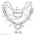 Fig. 11 - Passive nose bridge pressure distributing insert