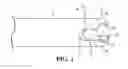 Fig. 02 - Archflo midline catheter