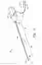 Fig. 02 - Echogenic coil member for a catheter assembly