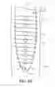 Fig. 04 - Self-offsetting implantable catheter system