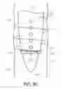 Fig. 08 - Self-offsetting implantable catheter system