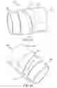 Fig. 29 - Surgical instrument for removing an implanted object