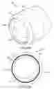 Fig. 33 - Surgical instrument for removing an implanted object