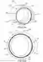 Fig. 34 - Surgical instrument for removing an implanted object