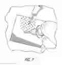 Fig. 07 - Bioelectric hydrogels and methods of manufacture and use